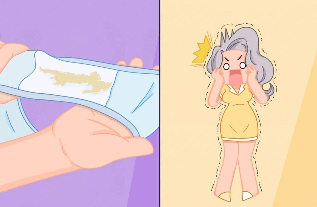 排卵期有白色豆腐渣样