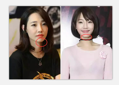 白百合是什么脸型