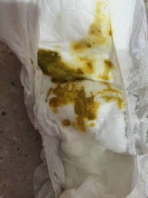宝宝拉绿便怎么办