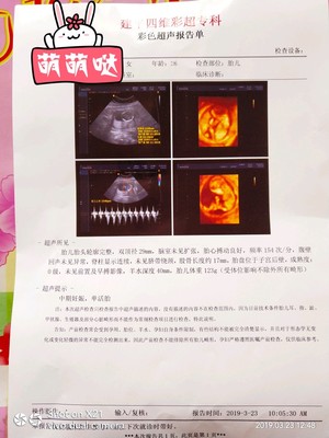 四个月可以做四维彩超吗