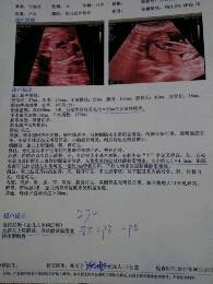 孕妇需要做心脏彩超吗