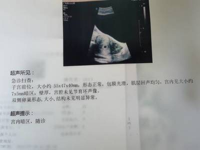 查白带可以查出怀孕吗