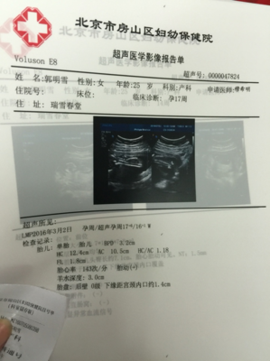 胎儿发育小