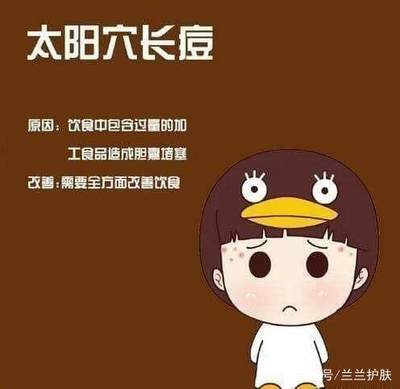 太阳穴痘痘成了包