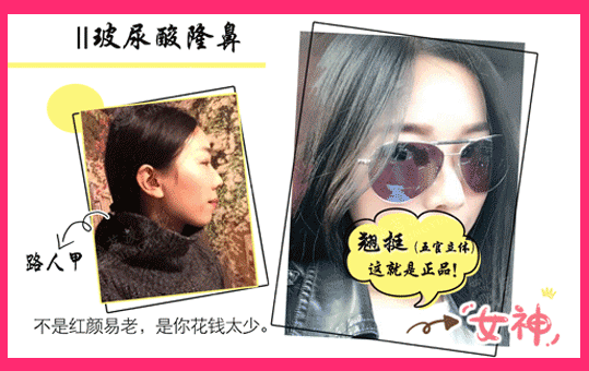 舒颜玻尿酸是大分子吗