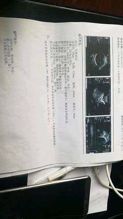 胎儿几周算足月