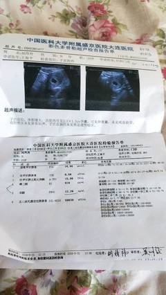 月经前三天会怀孕吗