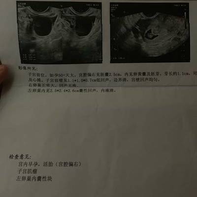 宝宝几周有胎心