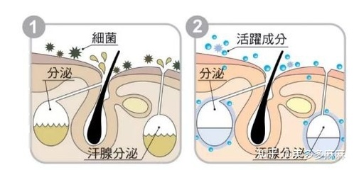 怀孕治脚气的土方法