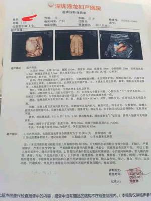 胆囊偏大是怎么回事
