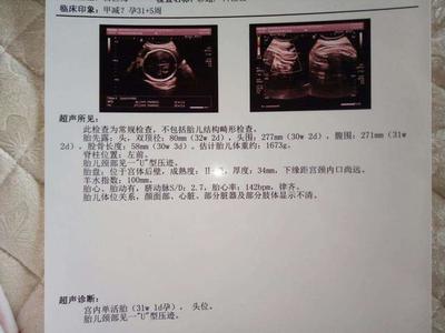 胎儿什么时候长脐带