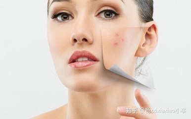 挤痘痘后毛孔粗大怎么办