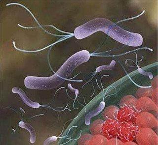 多少度水能杀死幽门螺旋杆菌