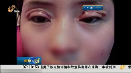 整容双眼皮的危害
