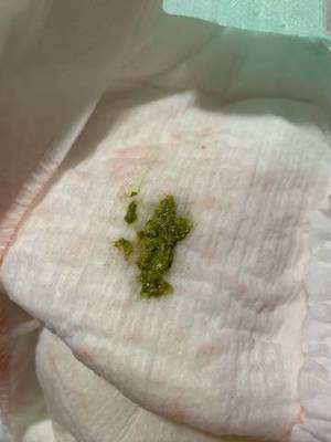 宝宝拉绿便怎么办