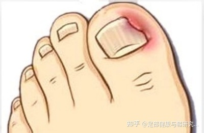 脚趾头疼痛是怎么回事