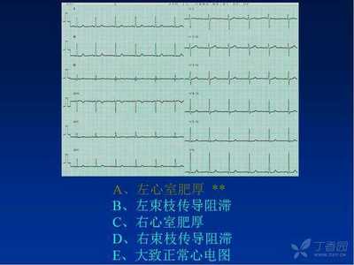 左心室阻滞是怎么回事