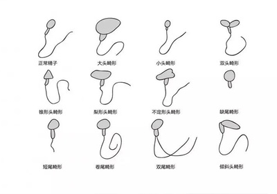 吞下精子会怀孕吗
