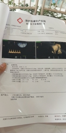 3个月可以药流吗
