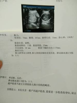 30周胎儿图片
