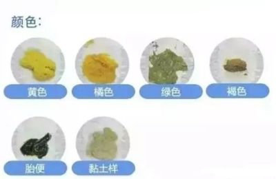 宝宝便便颜色