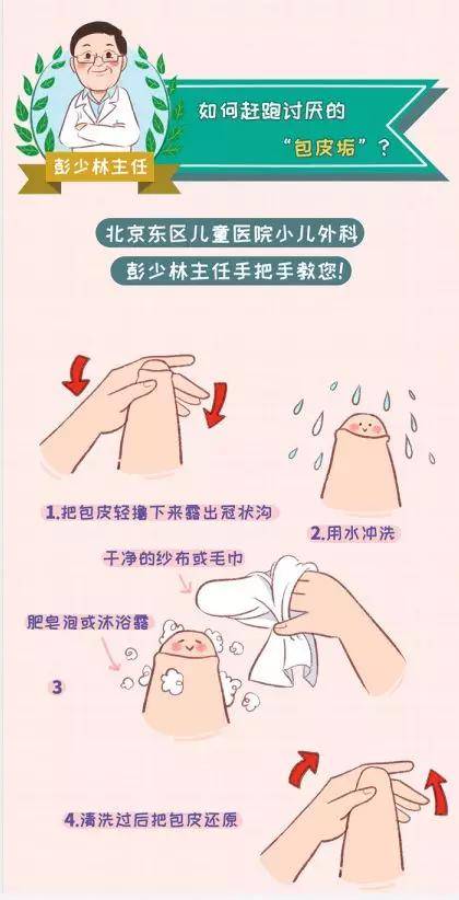 包皮垢是怎么回事