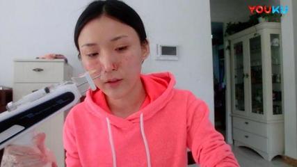 脸上长痘痘用打针