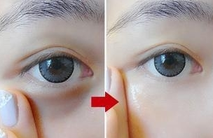 眼部肿胀