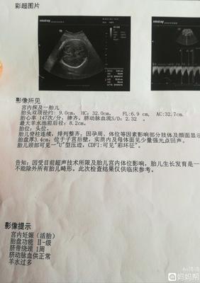 如何算宝宝体重