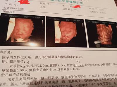 晕车对胎儿有影响吗
