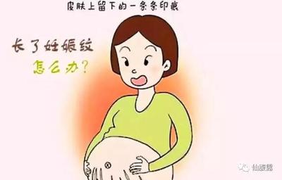 怀孕一个月会长妊娠纹吗