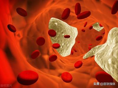 血液粘稠怎么治疗