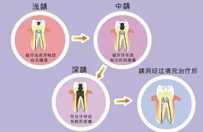 鞍是什么意思