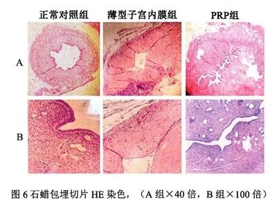 吃什么涨子宫内膜