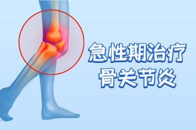 关节炎怎么治疗