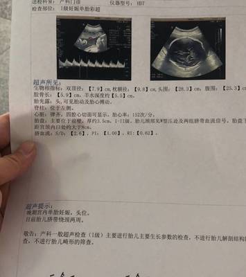 胎儿什么时候长脐带