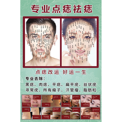 美容院祛痣多少钱一颗