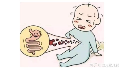 宝宝肝火旺
