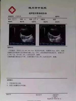 宫颈囊肿是怎么回事