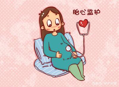 胎儿胎心