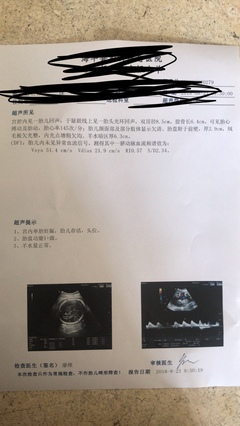 31周胎儿一般多重