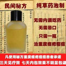 祛痘的草药