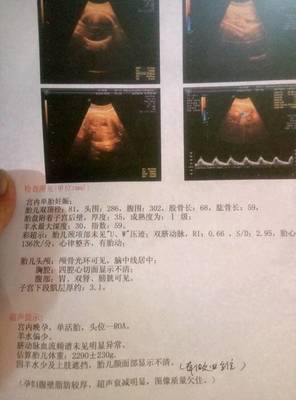 孕35周几个月
