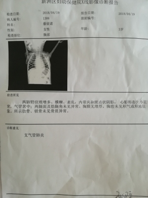 两岁宝宝发烧38度