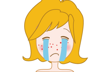衡阳 痘痘