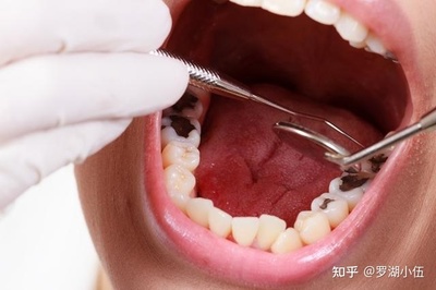 牙龈疼怎么治疗