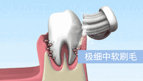 这几天感觉牙齿稣稣的