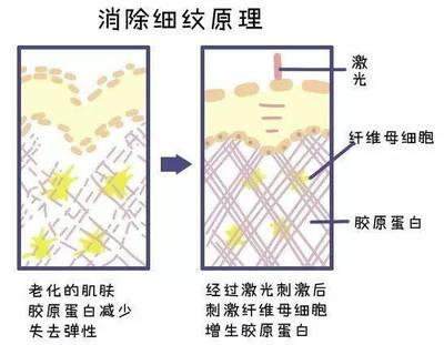 收缩毛孔的原理