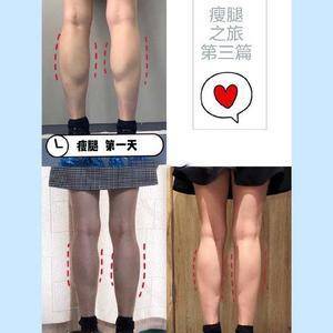 瘦腿哪里整容