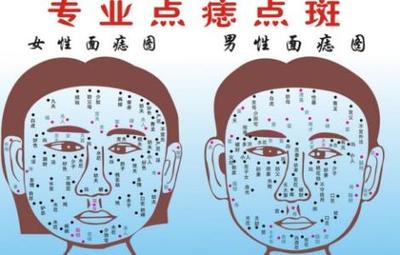 激光点痣会留疤